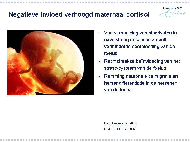 Negatieve invloed verhoogd maternaal cortisol • Vaatvernauwing van bloedvaten in navelstreng en placenta geeft