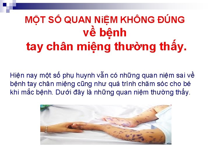  MỘT SỐ QUAN NiỆM KHÔNG ĐÚNG về bệnh tay chân miệng thường thấy.