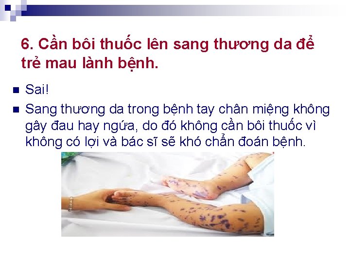 6. Cần bôi thuốc lên sang thương da để trẻ mau lành bệnh. n