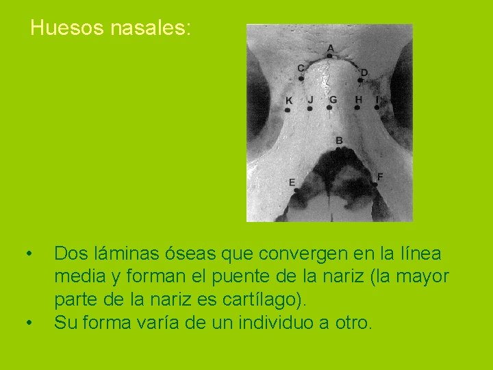 Huesos nasales: • • Dos láminas óseas que convergen en la línea media y
