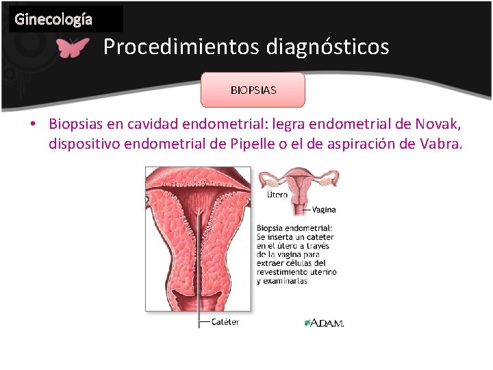 Ginecología Procedimientos diagnósticos BIOPSIAS • Biopsias en cavidad endometrial: legra endometrial de Novak, dispositivo