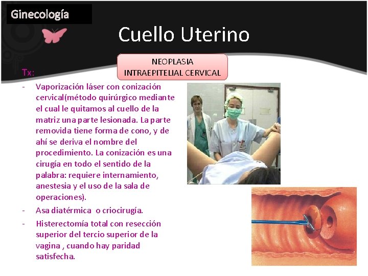 Ginecología Cuello Uterino NEOPLASIA INTRAEPITELIAL CERVICAL Tx: - Vaporización láser conización cervical(método quirúrgico mediante