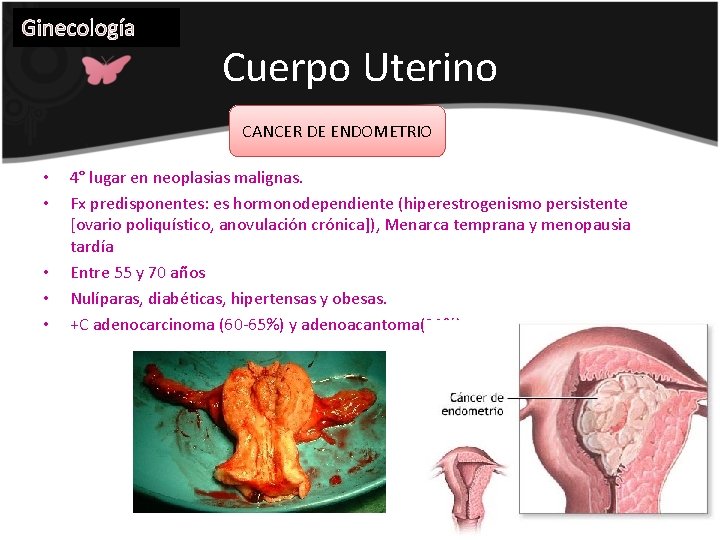 Ginecología Cuerpo Uterino CANCER DE ENDOMETRIO • • • 4° lugar en neoplasias malignas.