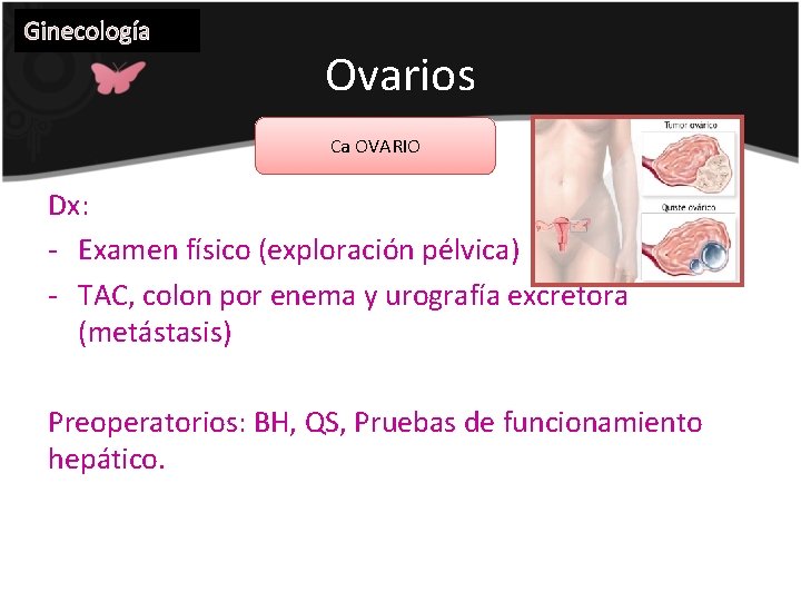 Ginecología Ovarios Ca OVARIO Dx: - Examen físico (exploración pélvica) - TAC, colon por