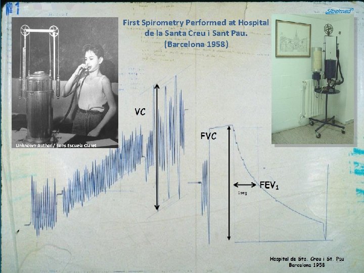 First Spirometry Performed at Hospital de la Santa Creu i Sant Pau. (Barcelona 1958)