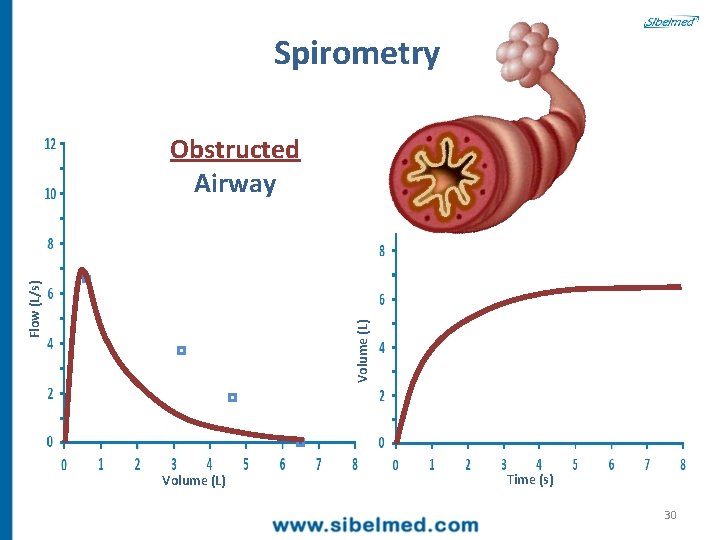 Spirometry Volume (L) Flow (L/s) Obstructed Airway Volume (L) Time (s) 30 