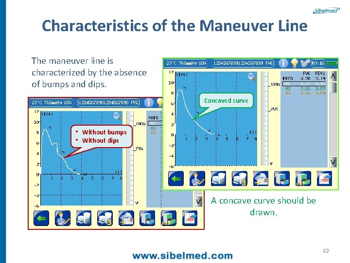 Characteristics of the Maneuver Line The maneuver line is characterized by the absence of
