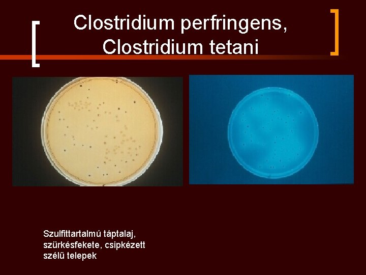 Clostridium perfringens, Clostridium tetani Szulfittartalmú táptalaj, szürkésfekete, csipkézett szélű telepek 