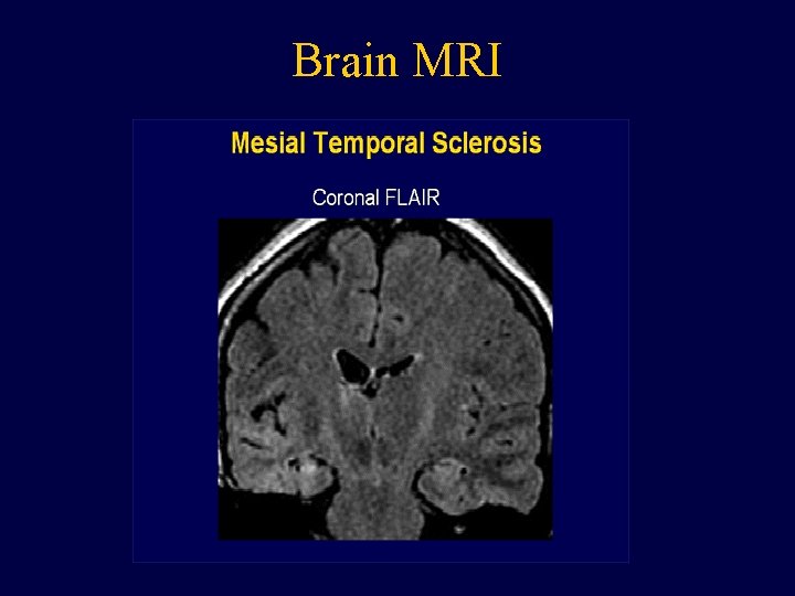 Brain MRI 