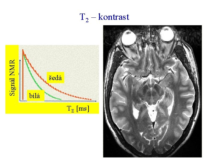  Signál NMR T 2 – kontrast šedá bílá TE [ms] 