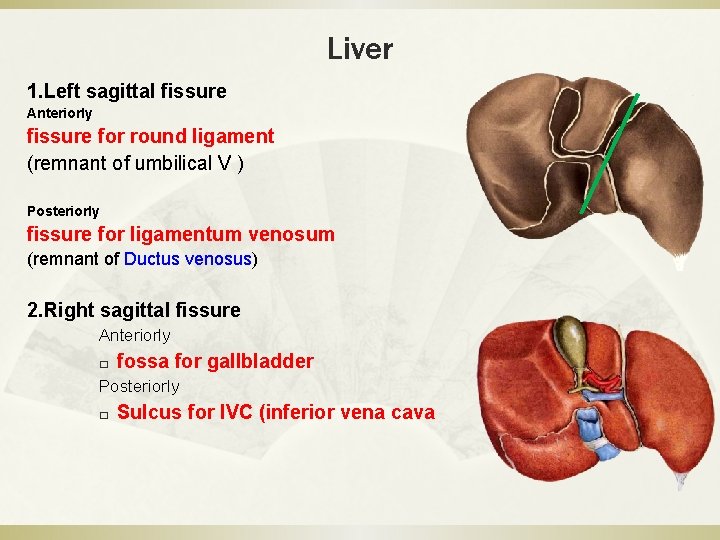 Liver 1. Left sagittal fissure Anteriorly fissure for round ligament (remnant of umbilical V