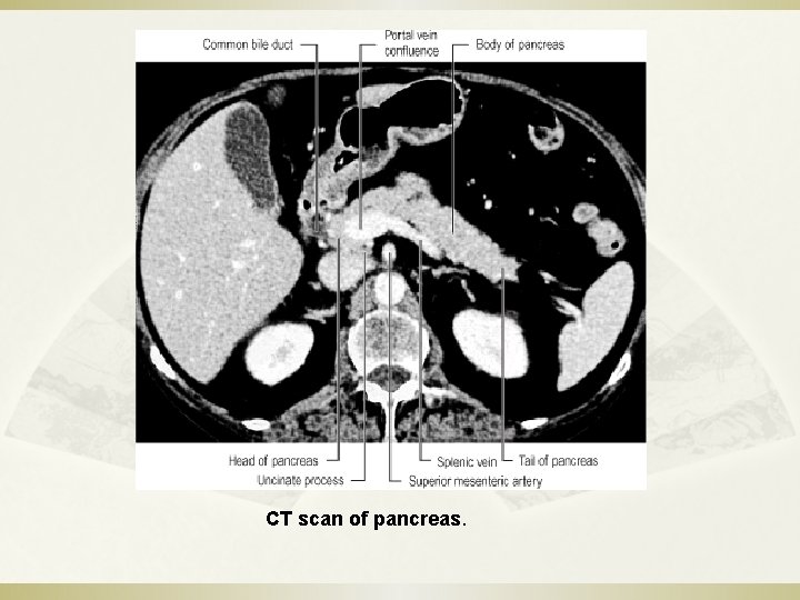 CT scan of pancreas. 