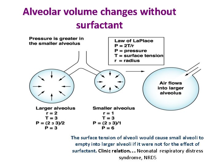 Alveolar volume changes without surfactant The surface tension of alveoli would cause small alveoli