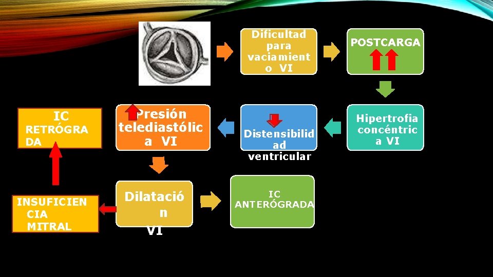 Dificultad para vaciamient o VI IC RETRÓGRA DA INSUFICIEN CIA MITRAL Presión telediastólic a