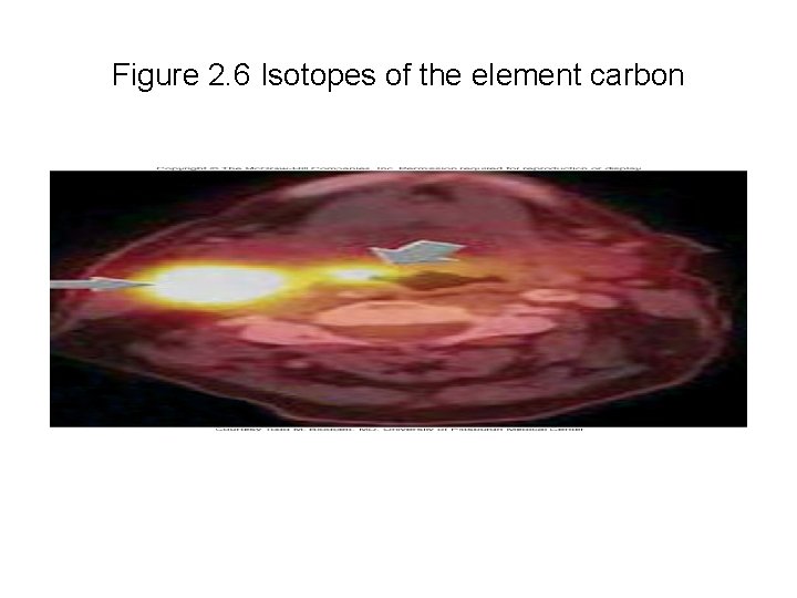 Figure 2. 6 Isotopes of the element carbon 