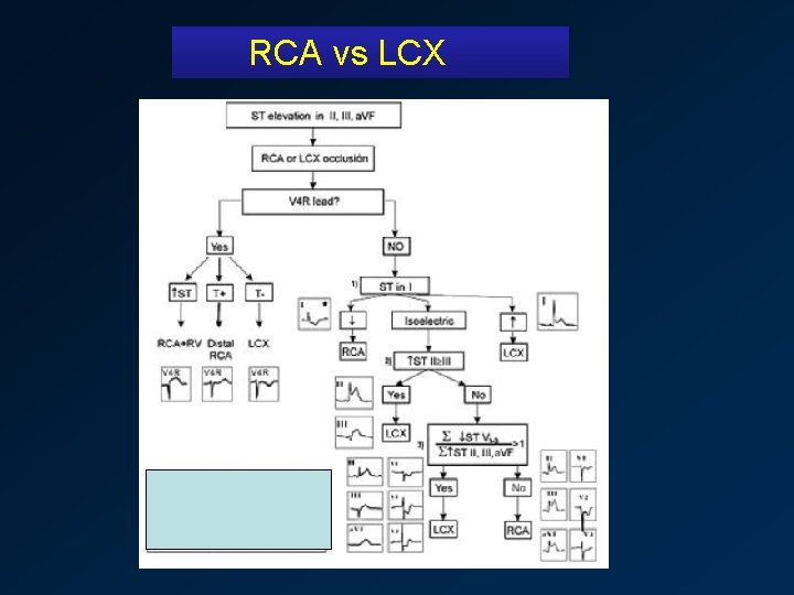 RCA vs LCX 
