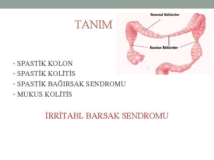 TANIM • SPASTİK KOLON • SPASTİK KOLİTİS • SPASTİK BAĞIRSAK SENDROMU • MUKUS KOLİTİS