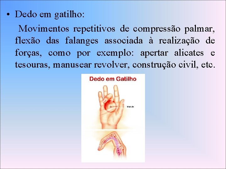 • Dedo em gatilho: Movimentos repetitivos de compressão palmar, flexão das falanges associada