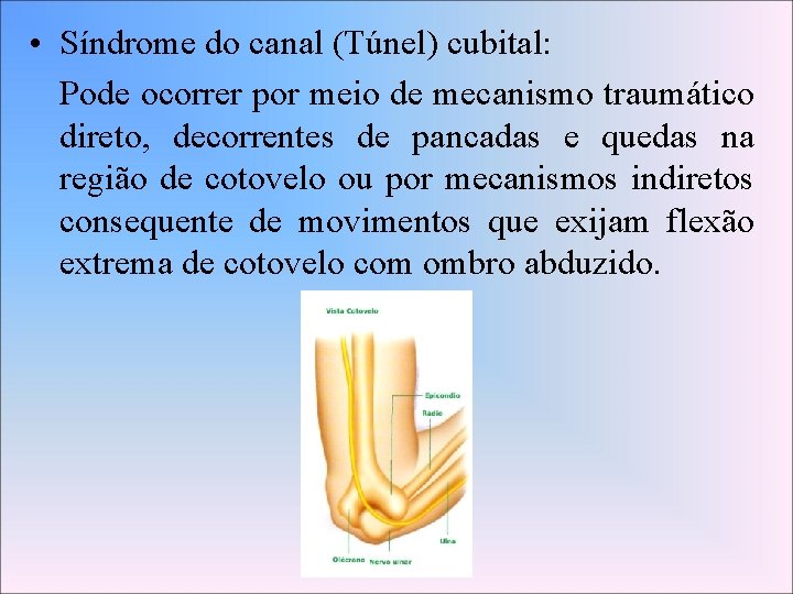  • Síndrome do canal (Túnel) cubital: Pode ocorrer por meio de mecanismo traumático