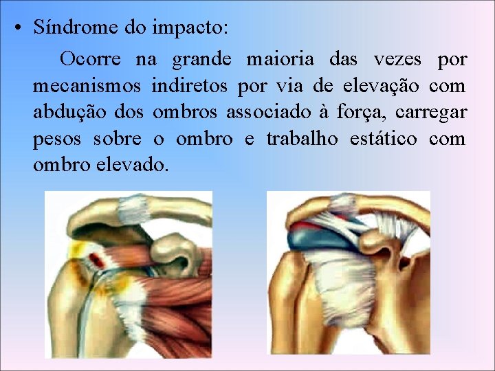  • Síndrome do impacto: Ocorre na grande maioria das vezes por mecanismos indiretos