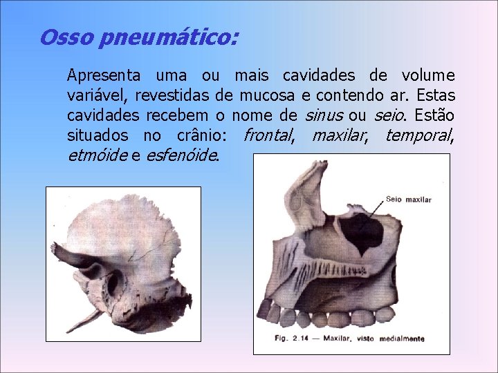 Osso pneumático: Apresenta uma ou mais cavidades de volume variável, revestidas de mucosa e