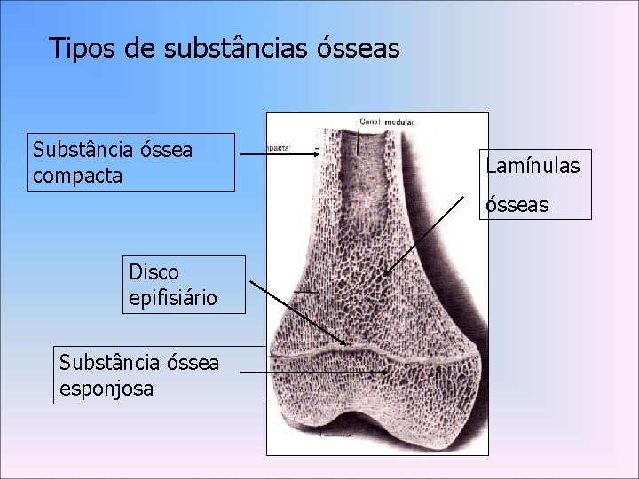 Tipos de substâncias ósseas Substância óssea compacta Lamínulas ósseas Disco epifisiário Substância óssea esponjosa