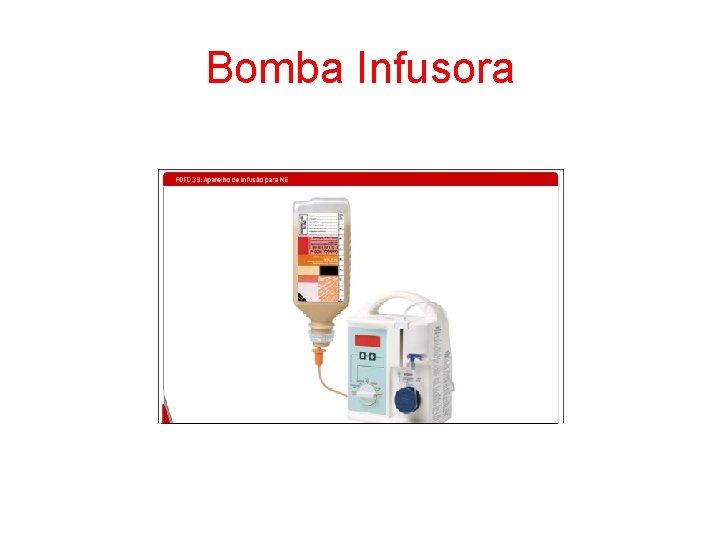 Bomba Infusora 