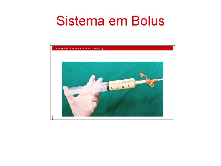 Sistema em Bolus 