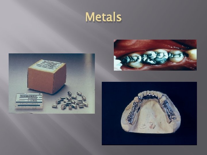 Metals 