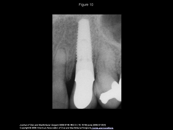 Figure 10 Journal of Oral and Maxillofacial Surgery 2009 6740 -48 DOI: (10. 1016/j.