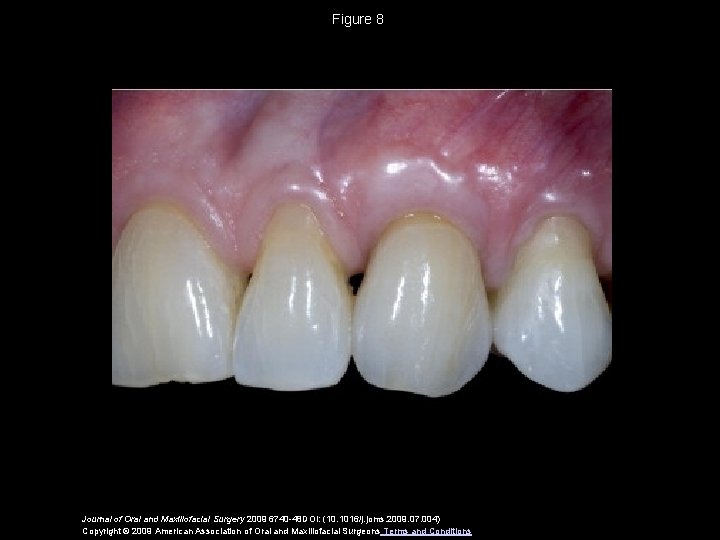 Figure 8 Journal of Oral and Maxillofacial Surgery 2009 6740 -48 DOI: (10. 1016/j.