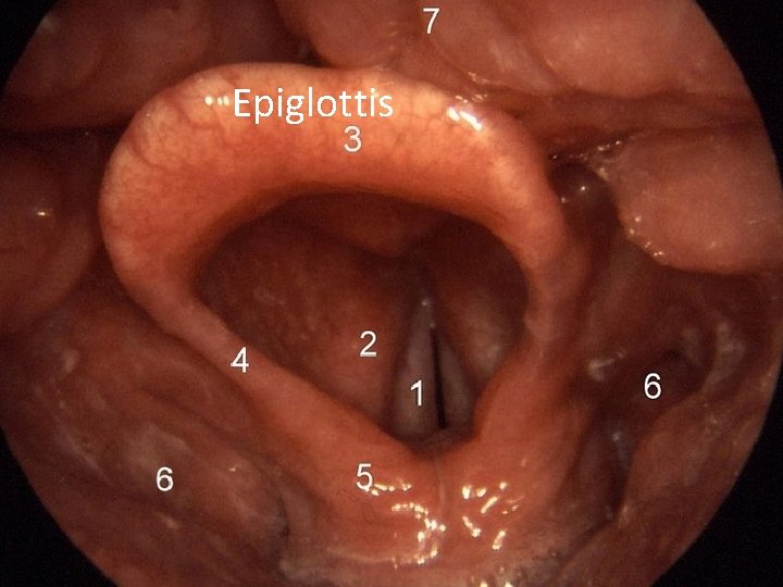 Epiglottis 