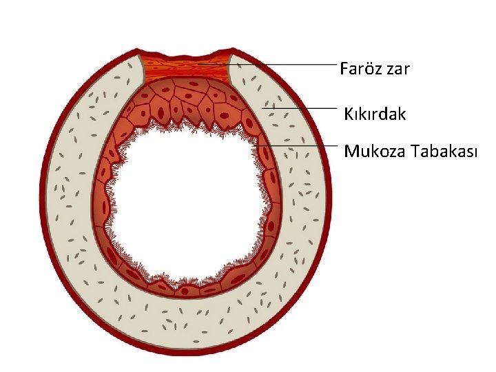 Faröz zar Kıkırdak Mukoza Tabakası 