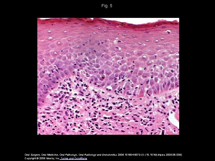 Fig. 5 Oral Surgery, Oral Medicine, Oral Pathology, Oral Radiology and Endodontics 2006 101604