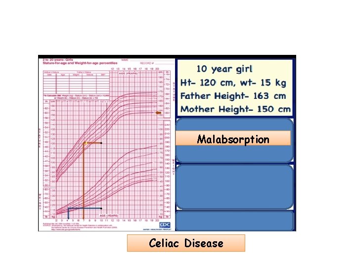 Malabsorption Celiac Disease 