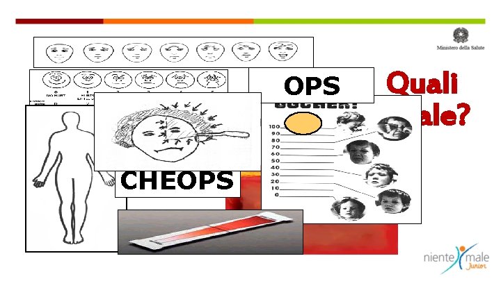 OPS CHEOPS Quali Scale? 