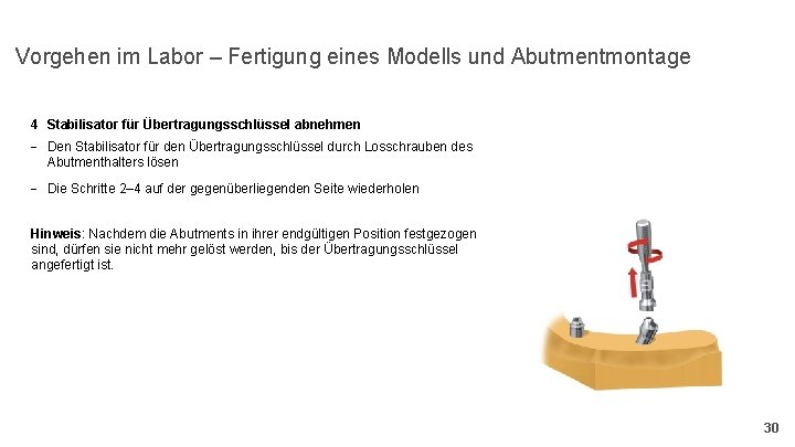 Vorgehen im Labor – Fertigung eines Modells und Abutmentmontage 4 Stabilisator für Übertragungsschlüssel abnehmen