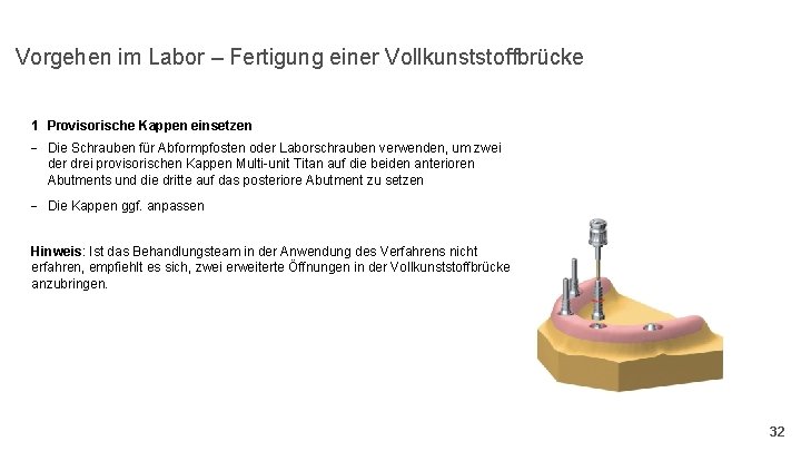 Vorgehen im Labor – Fertigung einer Vollkunststoffbrücke 1 Provisorische Kappen einsetzen - Die Schrauben