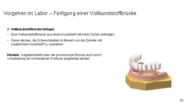 Vorgehen im Labor – Fertigung einer Vollkunststoffbrücke 2 Vollkunststoffbrücke fertigen - Eine Vollkunststoffbrücke aus