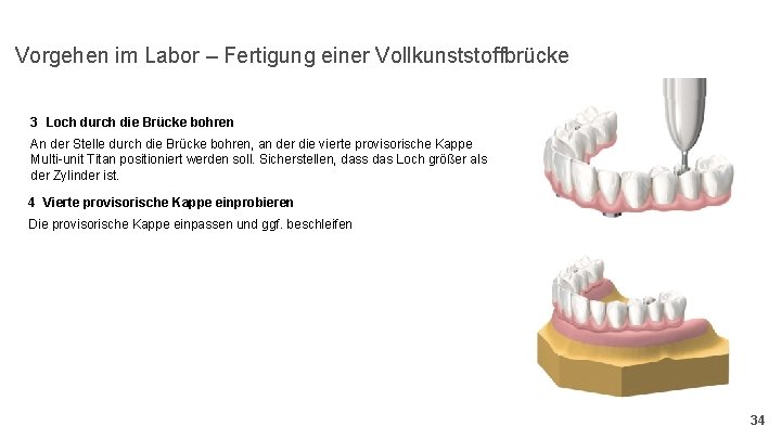 Vorgehen im Labor – Fertigung einer Vollkunststoffbrücke 3 Loch durch die Brücke bohren An