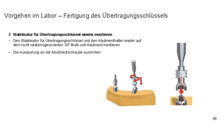 Vorgehen im Labor – Fertigung des Übertragungsschlüssels 2 Stabilisator für Übertragungsschlüssel wieder montieren -