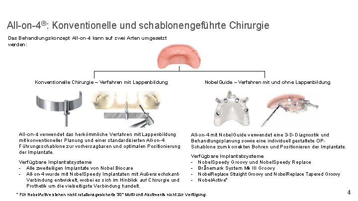 All-on-4®: Konventionelle und schablonengeführte Chirurgie Das Behandlungskonzept All-on-4 kann auf zwei Arten umgesetzt werden: