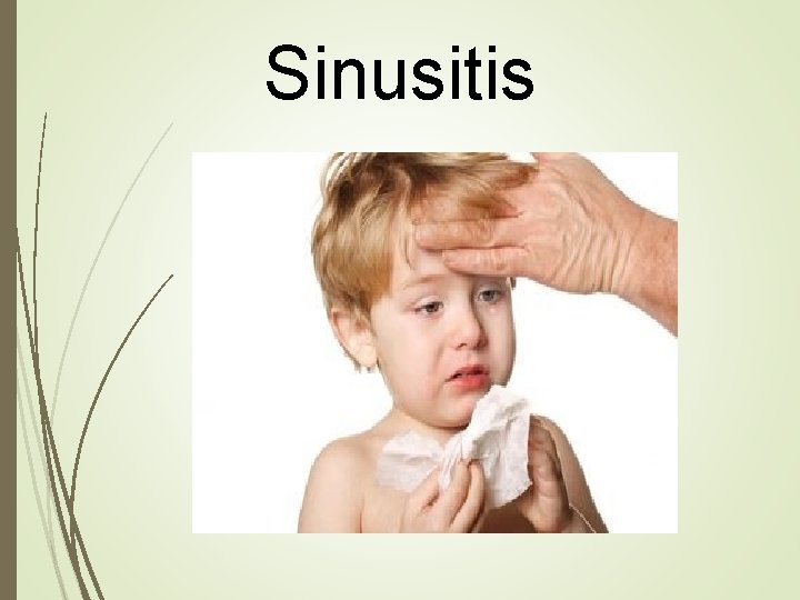 Sinusitis 