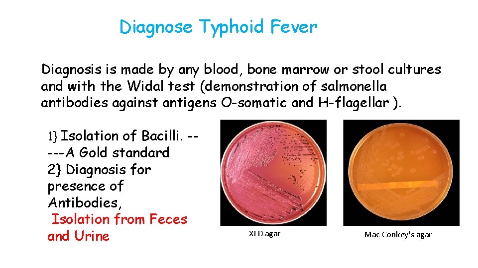 Diagnose Typhoid Fever Diagnosis is made by any blood, bone marrow or stool cultures