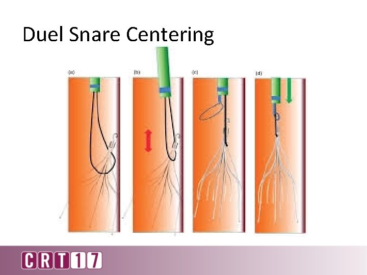 Duel Snare Centering 