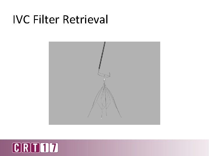 IVC Filter Retrieval 