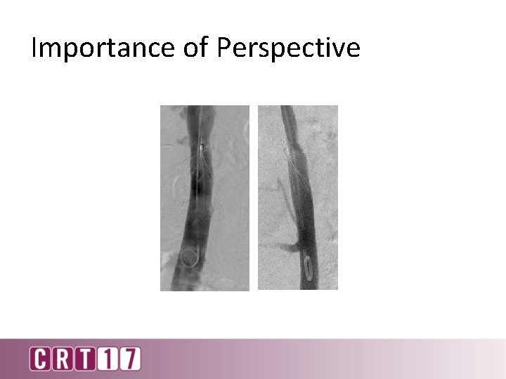 Importance of Perspective 