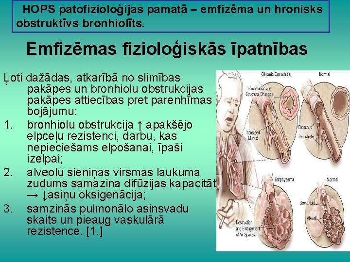  HOPS patofizioloģijas pamatā – emfizēma un hronisks obstruktīvs bronhiolīts. Emfizēmas fizioloģiskās īpatnības Ļoti