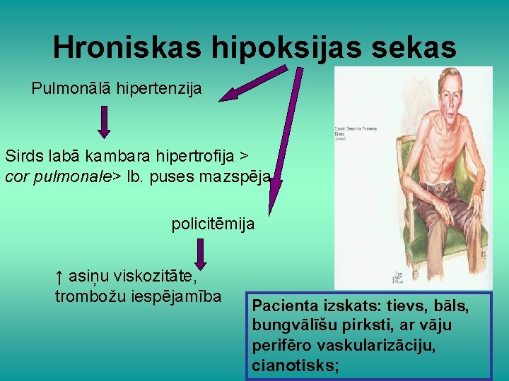 Hroniskas hipoksijas sekas Pulmonālā hipertenzija Sirds labā kambara hipertrofija > cor pulmonale> lb. puses