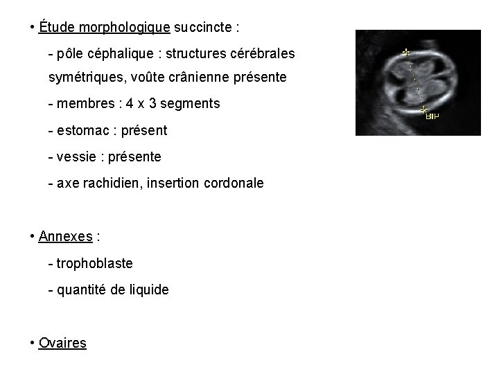  • Étude morphologique succincte : - pôle céphalique : structures cérébrales symétriques, voûte